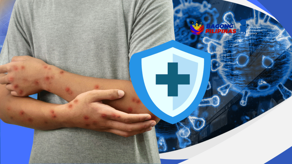 doh-mpox-filephoto